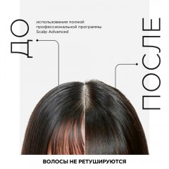 Шампунь для чувствительной кожи головы L'Oreal Professionnel Scalp Advanced Anti-discomfort Лореаль Профессионал Скальп Адвансед Анти-Дискомф 500мл